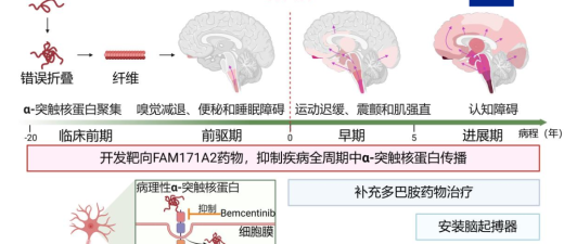 全球首次！中國團隊發布突破性成果 帕金森患者有希望了