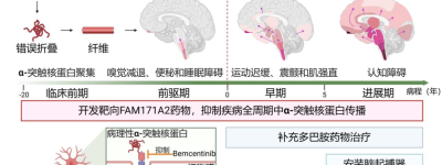 全球首次！中國團隊發布突破性成果 帕金森患者有希望了